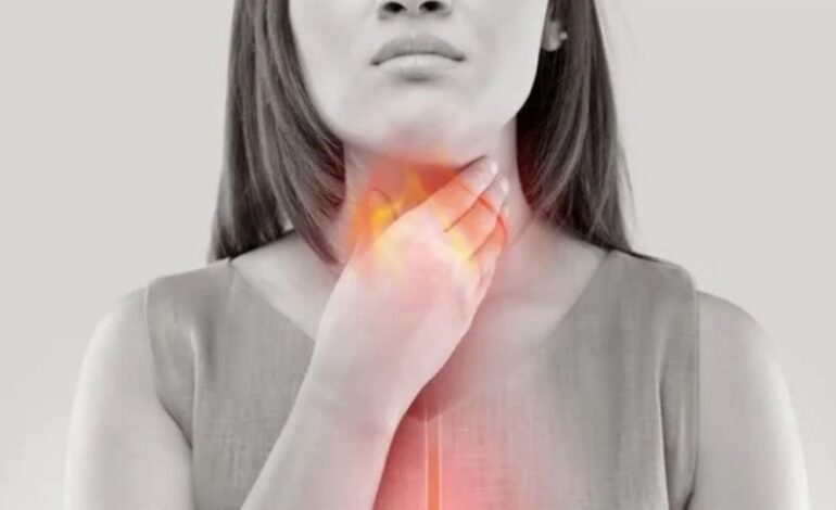 Remedios caseros y sencillos para la acidez